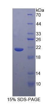 Rabbit TNF Alpha Protein (Recombinant His-T7)