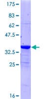 Human PKIG Protein (Recombinant GST)