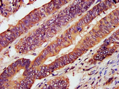Polyclonal Rabbit anti-Human CXCR3 Antibody (IHC, IF, WB)