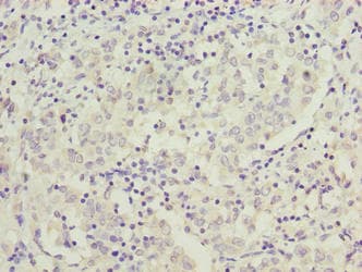 Polyclonal Rabbit anti-Human C9orf64 Antibody (IHC, WB)