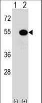 MAPKAPK5 / PRAK Antibody (Thr182)