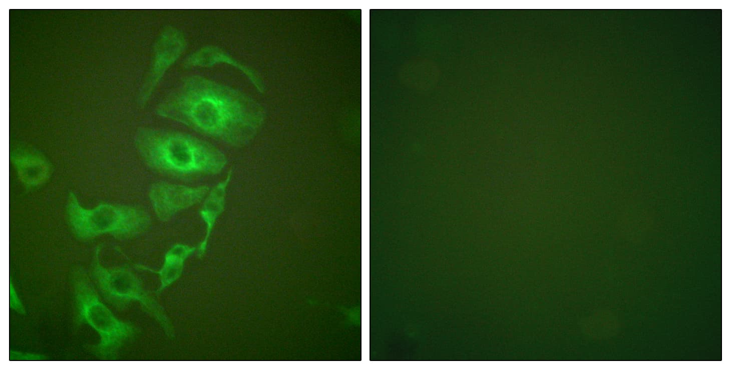 IHC-plus™ KRT17 / CK17 / Cytokeratin 17 Antibody (aa381-430)