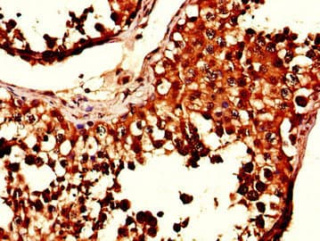SIK1 / MSK Antibody
