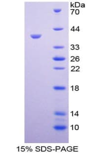 Mouse TPBG / 5T4 Protein (Recombinant His, N-Terminal)