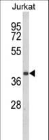 CCR3 Antibody (aa291-318)