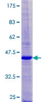 Human GP9 / CD42a Protein (Recombinant GST)