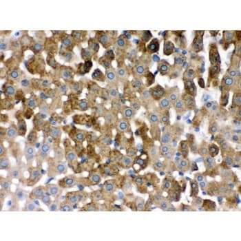 Polyclonal Rabbit anti-Human SULT2A1 / Sulfotransferase 2A1 Antibody (aa253-285, IHC, WB)