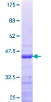 Human DDX24 Protein (Recombinant GST, N-terminus)