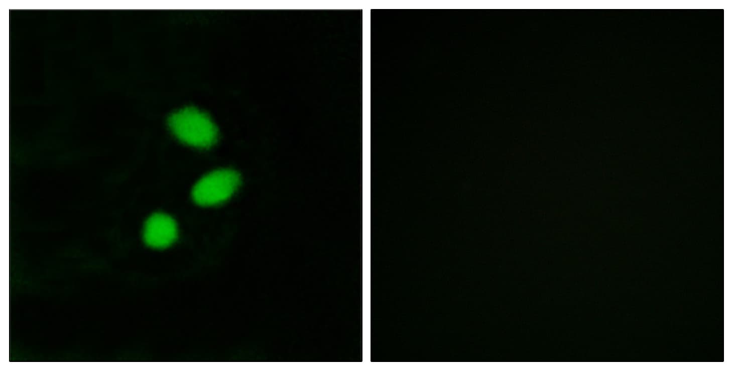TSHZ2 Antibody (aa811-860)