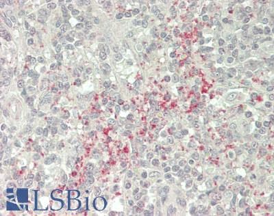 IHC-plus™ SELP / P-Selectin / CD62P Antibody (81-130 aa, N-terminal)