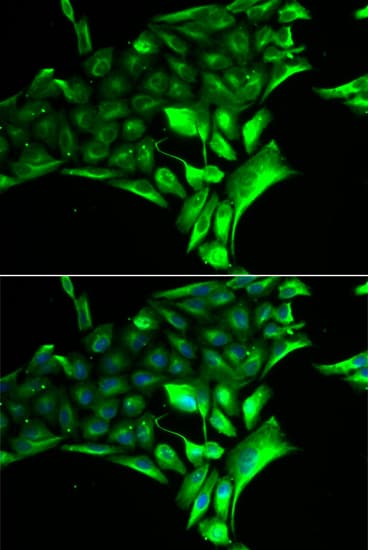 Polyclonal Rabbit anti-Human GPBB / PYGB Antibody (IHC, IF, WB)