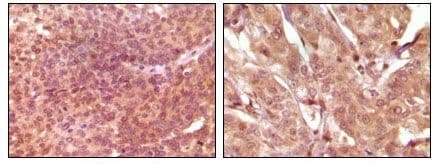 SRA1 / SRA Antibody (clone 7H1G1)