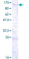 Human NOL10 Protein (Recombinant GST)