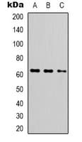 Polyclonal Rabbit anti-Human FUBP3 Antibody (Internal, IHC, WB)