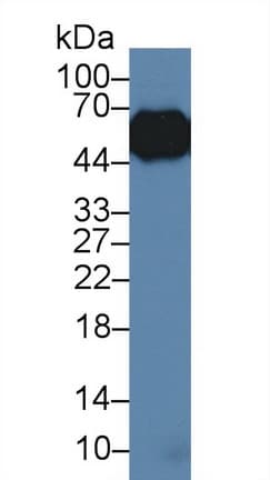 ORM1 / Orosomucoid Antibody (aa2-171, Biotin)
