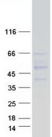 Human SASH3 Protein (Recombinant Myc-DDK (Flag))