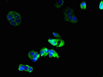 GJB6 / CX30 / Connexin 30 Antibody