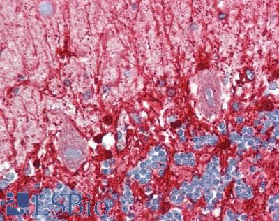 IHC-plus™ GLUD2 Antibody (aa319-558)