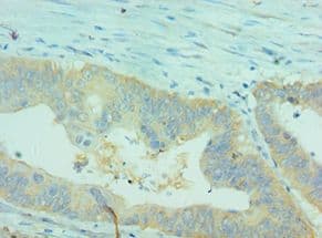 CLDN2 / Claudin 2 Antibody (aa30-230)