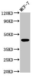 BDKRB2/Bradykinin B2 Receptor Antibody