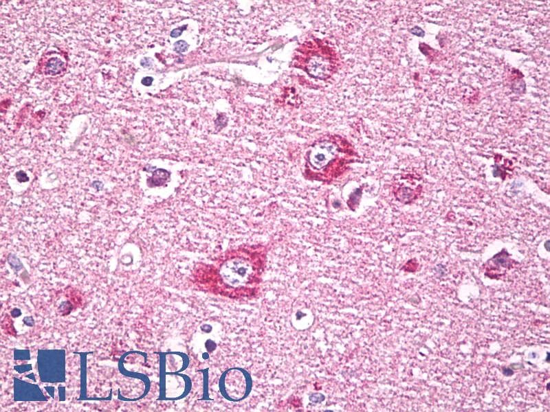 IHC-plus™ DACT1 / DAPPER Antibody (aa725-775)
