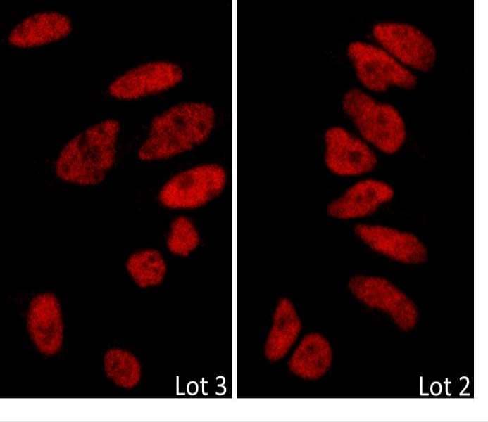 IHC-plus™ Polyclonal Rabbit anti-Human BRD2 / RING3 Antibody (aa675-725, IHC, IF, WB)