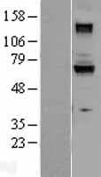 GUCY1B3 Protein (Over-Expression Lysate Myc-DDK (Flag))