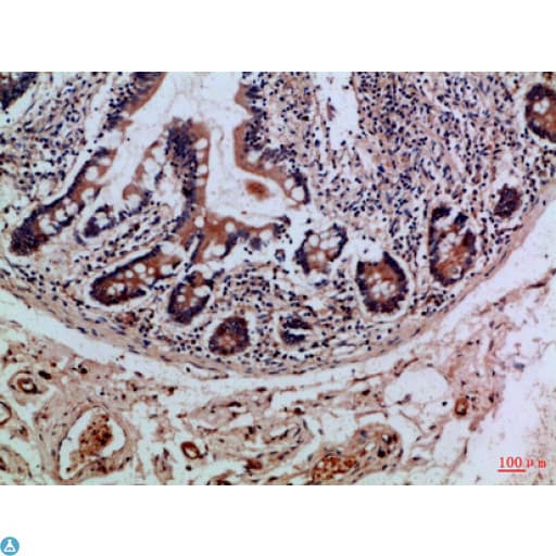 Polyclonal Rabbit anti-Human ITGAE / CD103 Antibody (WB)