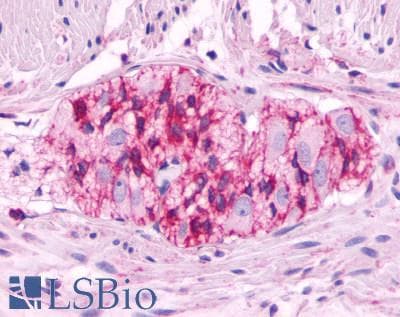 PathPlus™ LHCGR / LHR / LH Receptor Antibody (C-Terminus)