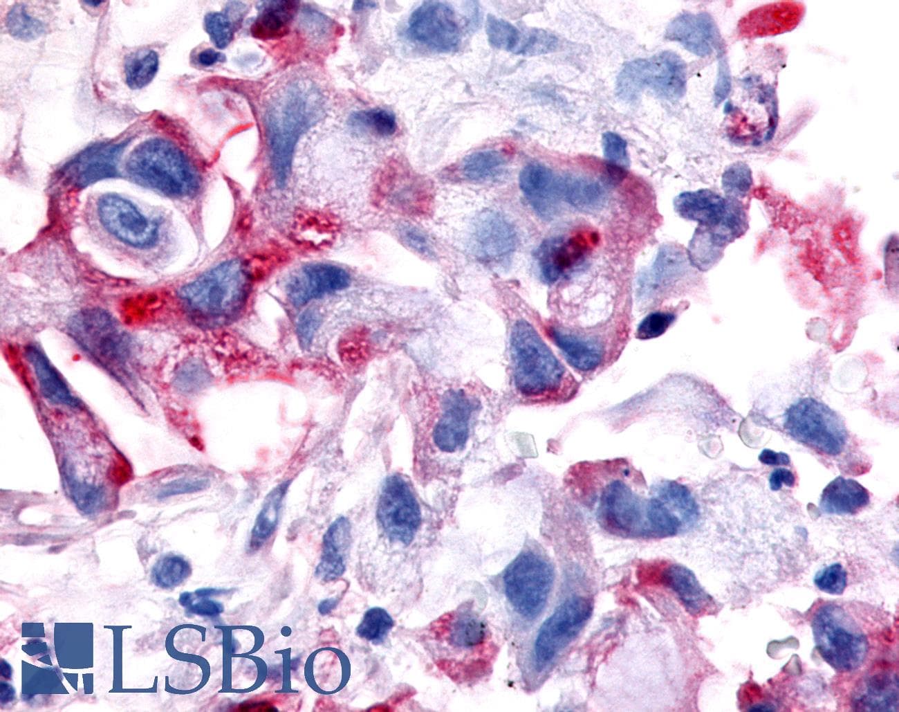PathPlus™ MST1R / RON Antibody (C-Terminus)