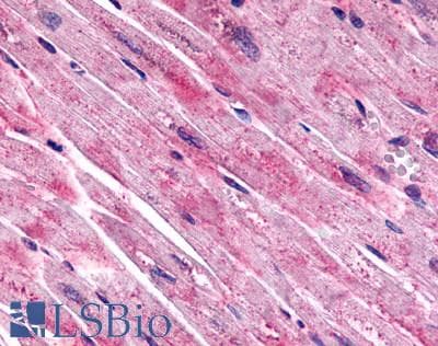 IHC-plus™ FZD7 / Frizzled 7 Antibody (N-Terminus)