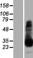 TPSAB1 / Mast Cell Tryptase Protein (Over-Expression Lysate Myc-DDK (Flag))