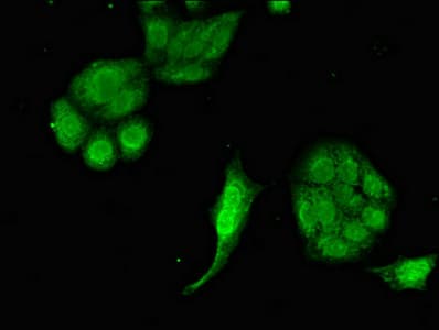 Polyclonal Rabbit anti-Human EIF2AK1 Antibody (IHC, IF, WB)