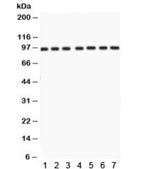 Polyclonal Rabbit anti-Human NBN / Nibrin Antibody (IHC, WB)