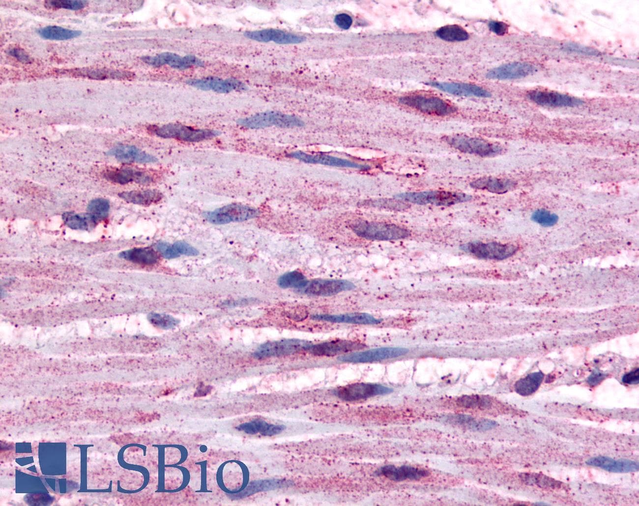 IHC-plus™ ADRA1B / Adrenoceptor alpha 1B Antibody (Cytoplasmic Domain)