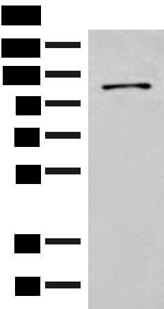 FANCB / FAB Antibody
