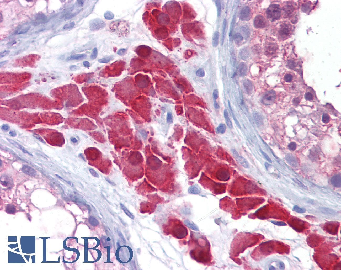 IHC-plus™ CCS Antibody (clone 1G1)