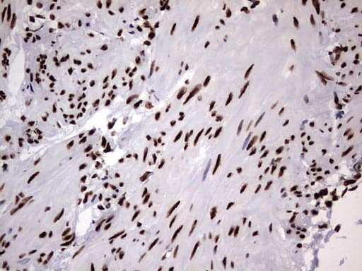HNRPM / HNRNPM Antibody (aa1-261, clone OTI4C9)