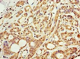 Polyclonal Rabbit anti-Human ACSM3 / SAH Antibody (aa387-586, IHC)