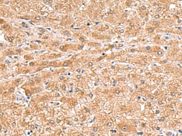 Polyclonal Rabbit anti-Human HMGCLL1 Antibody (IHC, WB)