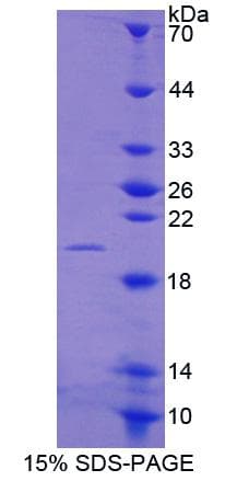 Mouse MMP13 Protein (Recombinant His)