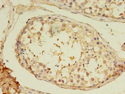 MYH7B Antibody
