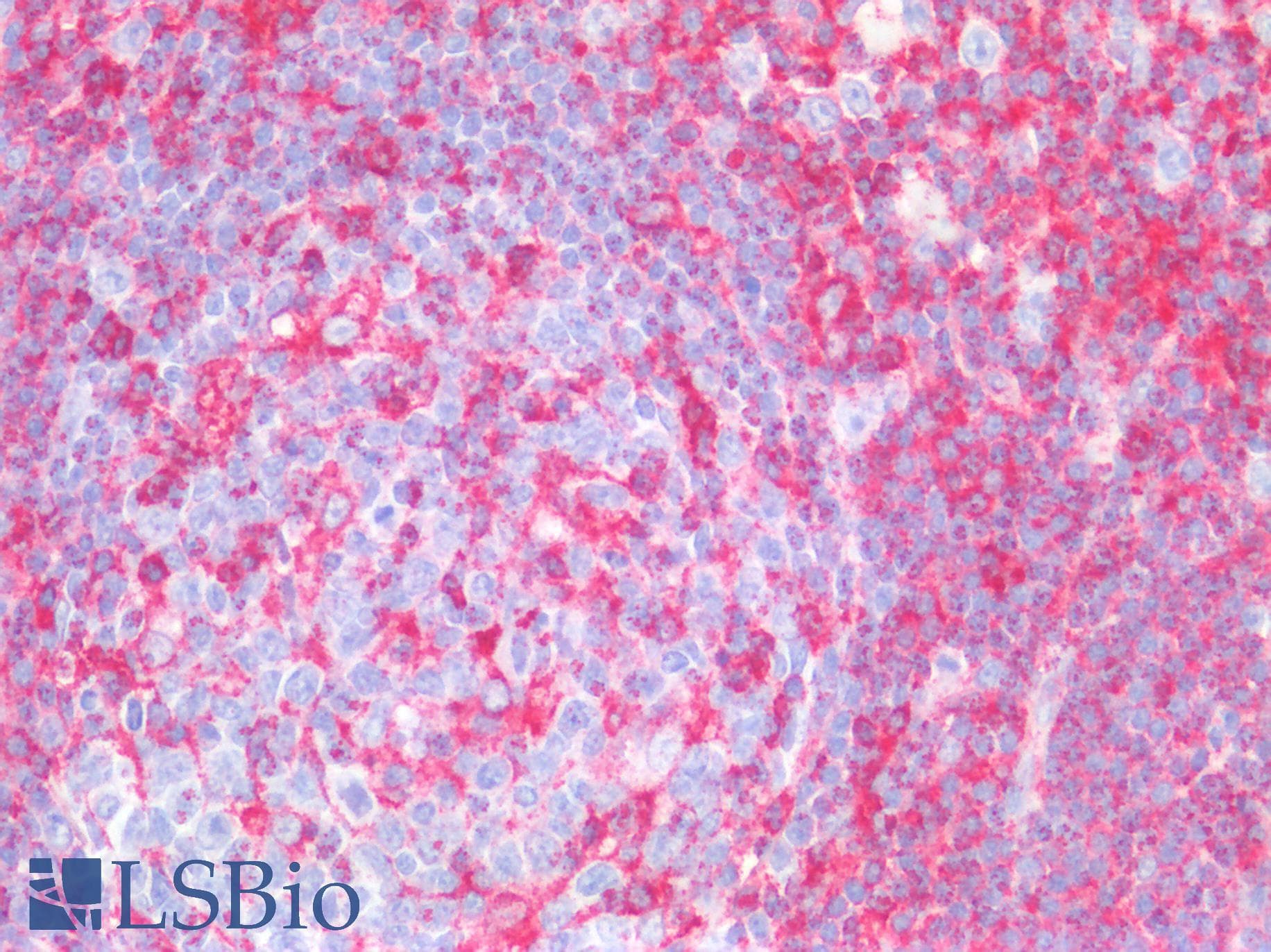 PathPlus™ MVP / VAULT1 Antibody (aa158-380)