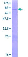 Human UXS1 Protein (Recombinant GST)
