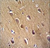 Polyclonal Rabbit anti-Human ENO2 / NSE Antibody (Tyr236, IHC, WB)