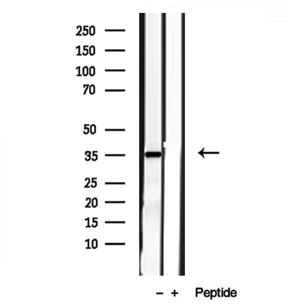 PYCR1 Antibody