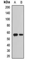 BACE1 / BACE Antibody