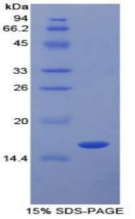 Pig TGFB1 / TGF Beta 1 Protein (Recombinant His)