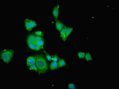 TAMM41 / C3orf31 Antibody