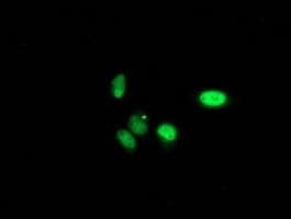 PNMT Antibody (clone OTI1B11)